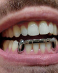 Ligne sur 6 dents