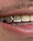 Dent pleine (ou contour) + ligne