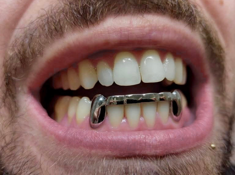 Ligne sur 6 dents