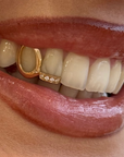 Dent pleine (ou contour) + ligne
