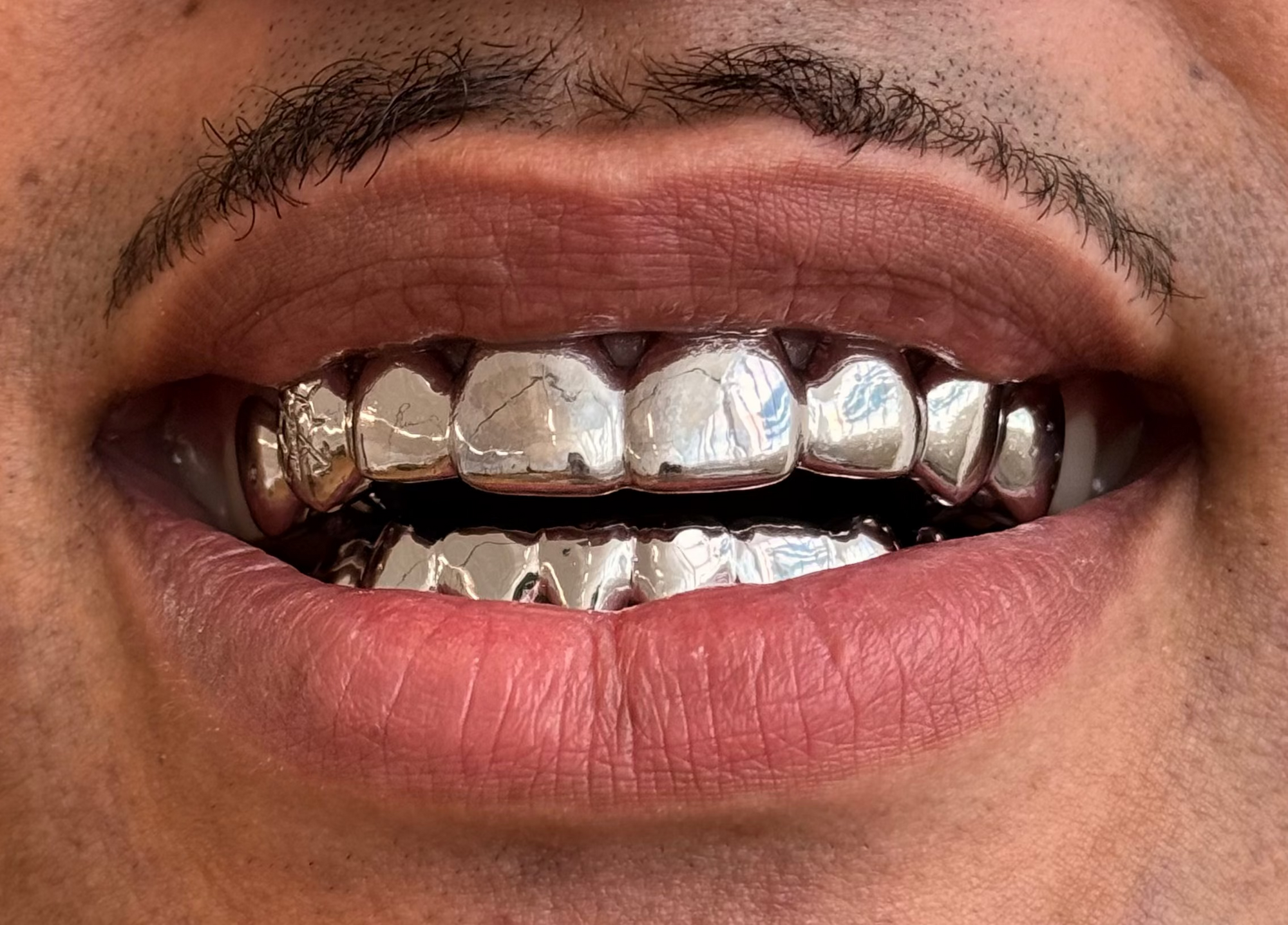 Dent pleine ou contour